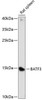 Epigenetics and Nuclear Signaling Antibodies 2 Anti-BATF3 Antibody CAB14906