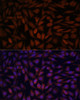 Signal Transduction Antibodies 2 Anti-KLHL8 Antibody CAB14917