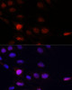 Signal Transduction Antibodies 2 Anti-KLHL8 Antibody CAB14917