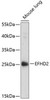 Signal Transduction Antibodies 2 Anti-EFHD2 Antibody CAB14926