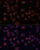 Cell Biology Antibodies 5 Anti-NTPCR Antibody CAB14944