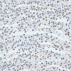 Epigenetics and Nuclear Signaling Antibodies 2 Anti-ZNF433 Antibody CAB14972