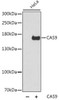 Cell Biology Antibodies 16 Anti-CAS9 Antibody CAB14997