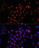 Cell Death Antibodies 1 Anti-SGMS1 Antibody CAB15008