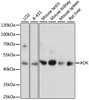 Metabolism Antibodies 1 Anti-ADK Antibody CAB15023