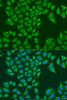 Cell Biology Antibodies 5 Anti-ALDH1B1 Antibody CAB15025