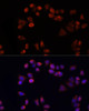 Immunology Antibodies 1 Anti-SLC25A4 Antibody CAB15027