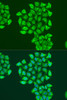 Cell Death Antibodies 1 Anti-BNIP3 Antibody CAB15032