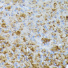 Cell Biology Antibodies 5 Anti-CTRB1 Antibody CAB15043