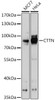 Cell Biology Antibodies 5 Anti-CTTN Antibody CAB15054