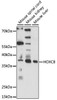 Epigenetics and Nuclear Signaling Antibodies 2 Anti-HOXC8 Antibody CAB15066