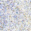 Cell Biology Antibodies 5 Anti-ITGAX Antibody CAB1508
