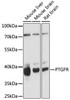 Cell Biology Antibodies 5 Anti-PTGFR Antibody CAB15088