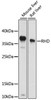 Immunology Antibodies 1 Anti-RHD Antibody CAB15092
