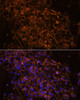 Signal Transduction Antibodies 2 Anti-SCNN1G Antibody CAB15097