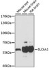 Neuroscience Anti-SLC6A1 Antibody CAB15099