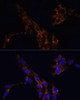 Cell Biology Antibodies 5 Anti-TGFB1 Antibody CAB15103