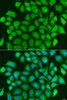 Cell Death Antibodies 1 Anti-TRAF3 Antibody CAB15106