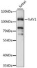Cell Biology Antibodies 5 Anti-VAV1 Antibody CAB15108