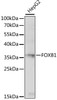 Epigenetics and Nuclear Signaling Antibodies 2 Anti-FOXB1 Antibody CAB15152