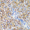 Metabolism Antibodies 1 Anti-PYCR2 Antibody CAB15155