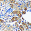 Metabolism Antibodies 1 Anti-PYCR2 Antibody CAB15155