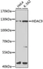 Epigenetics and Nuclear Signaling Antibodies 2 Anti-HDAC9 Antibody CAB1516