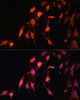 Cell Cycle Antibodies 1 Anti-PRR5 Antibody CAB15170