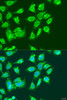 Cell Biology Antibodies 5 Anti-MCCC2 Antibody CAB15181