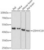 Cell Biology Antibodies 5 Anti-ZDHHC18 Antibody CAB15199