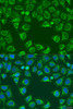 Cell Biology Antibodies 5 Anti-ALG2 Antibody CAB15203