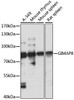 Cell Biology Antibodies 5 Anti-GIMAP8 Antibody CAB15213