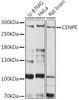 Cell Cycle Antibodies 1 Anti-CENPE Antibody CAB15263