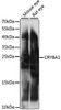Neuroscience Anti-CRYBA1 Antibody CAB15267