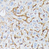 Cell Biology Antibodies 5 Anti-CTNNA2 Antibody CAB15269