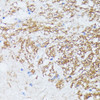 Cell Biology Antibodies 5 Anti-CTNNA2 Antibody CAB15269