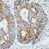 Metabolism Antibodies 1 Anti-IVD Antibody CAB15281