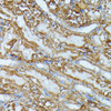 Metabolism Antibodies 1 Anti-IVD Antibody CAB15281