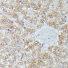 Metabolism Antibodies 1 Anti-IVD Antibody CAB15281