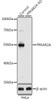 KO Validated Antibodies 1 Anti-PRKAR2A Antibody CAB1531KO Validated