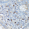 Cell Biology Antibodies 5 Anti-RNASE6 Antibody CAB15312