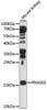 Cell Biology Antibodies 5 Anti-RNASE6 Antibody CAB15312