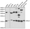 Cell Biology Antibodies 5 Anti-RPS25 Antibody CAB15314