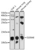 Cell Death Antibodies 1 Anti-S100A8 Antibody CAB15315