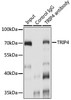 Epigenetics and Nuclear Signaling Antibodies 2 Anti-TRIP4 Antibody CAB15352