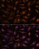 Metabolism Antibodies 1 Anti-EEF1E1 Antibody CAB15357