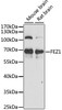 Signal Transduction Antibodies 2 Anti-FEZ1 Antibody CAB15362