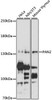 Epigenetics and Nuclear Signaling Antibodies 2 Anti-PAN2 Antibody CAB15373