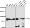 Cell Biology Antibodies 6 Anti-GFPT2 Antibody CAB15374