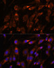 Metabolism Antibodies 1 Anti-FARSB Antibody CAB15375